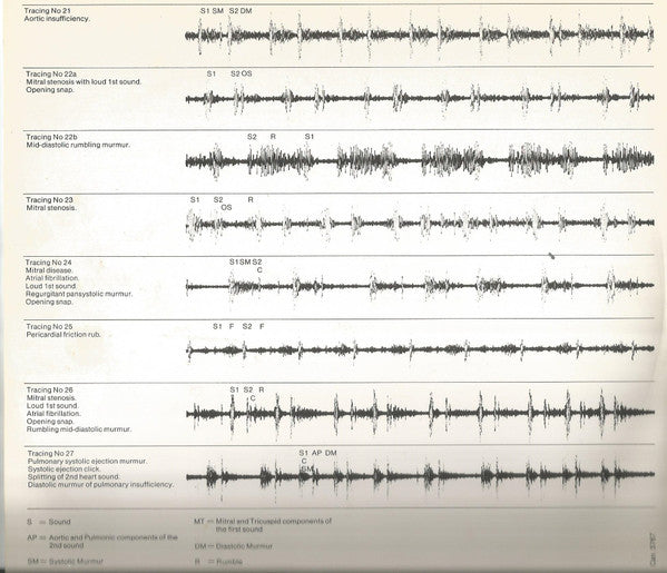 Dr. Yves Morin : Heart Auscultation (Examples Of Common Abnormalities) (10")